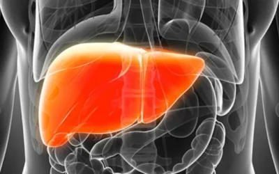 Nonalcoholic fatty liver disease (NAFLD)