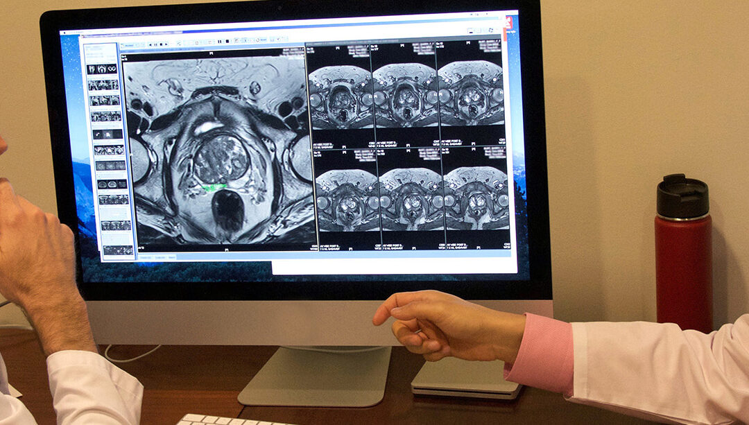 Prostate Cancer Prospectus: What You Need to Know About Prostate Cancer Screening